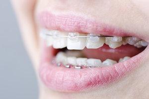 Practice Orthodontics Sydney Wide - Parramatta, Parramatta, NSW